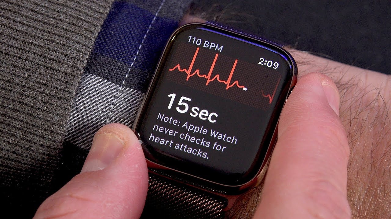 apple watch EKG