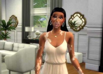 EA ve Maxis The Sims 4'te Vitiligo Dış Görünüm Özelliğini Duyurdu!