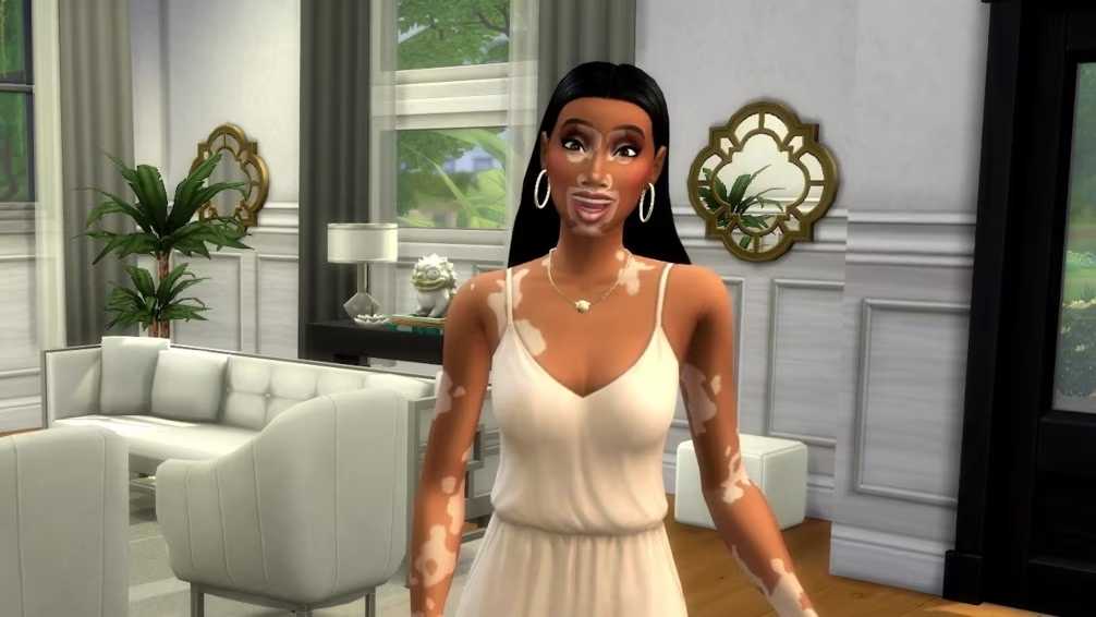 EA ve Maxis The Sims 4'te Vitiligo Dış Görünüm Özelliğini Duyurdu!